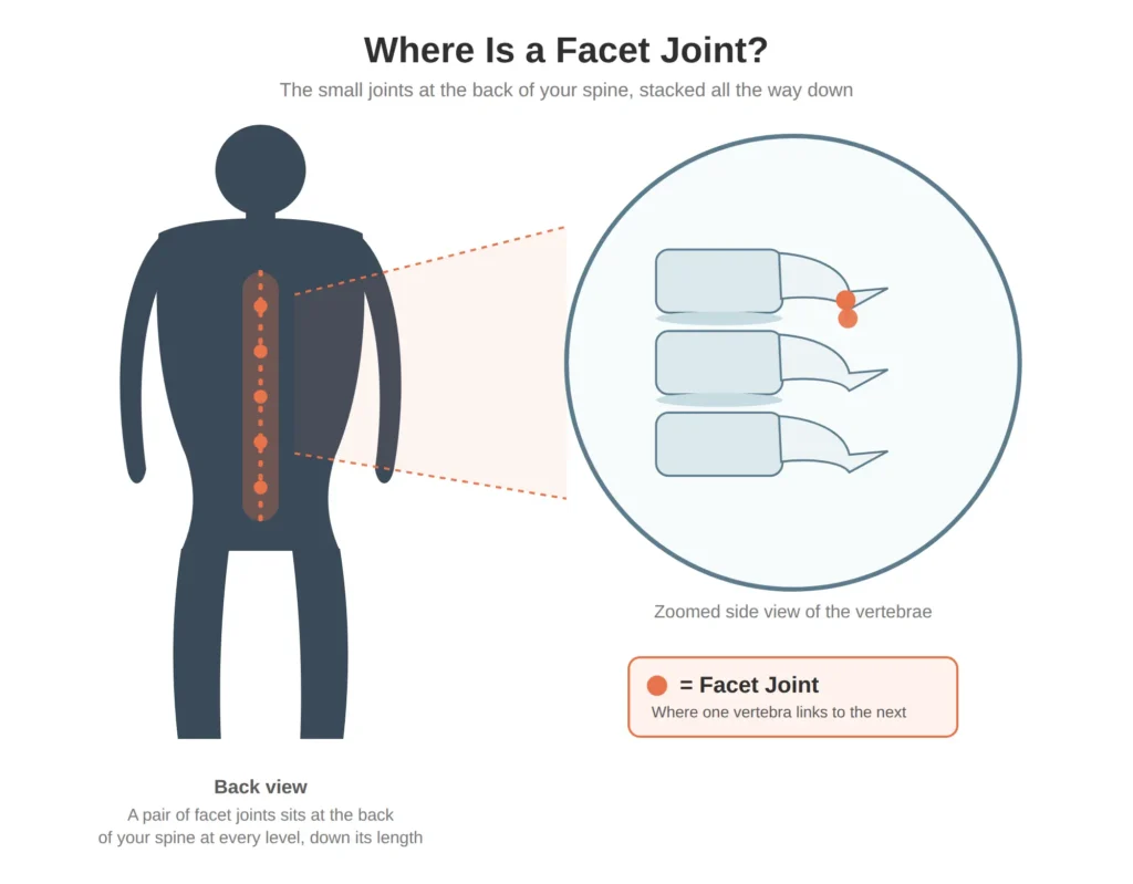 Diagram showing the location of a facet joint between two vertebrae in the lower back